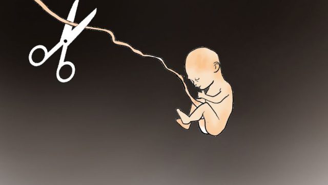 Aborsi